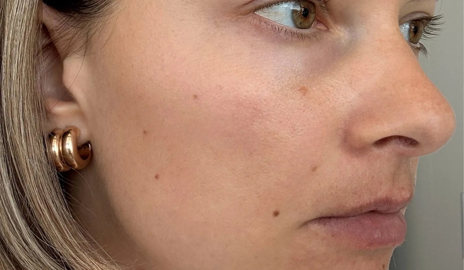 Nahaufnahme einer Frau nach 8 Wochen Anwendung von Beauty Fellows Hautpflegeprodukten